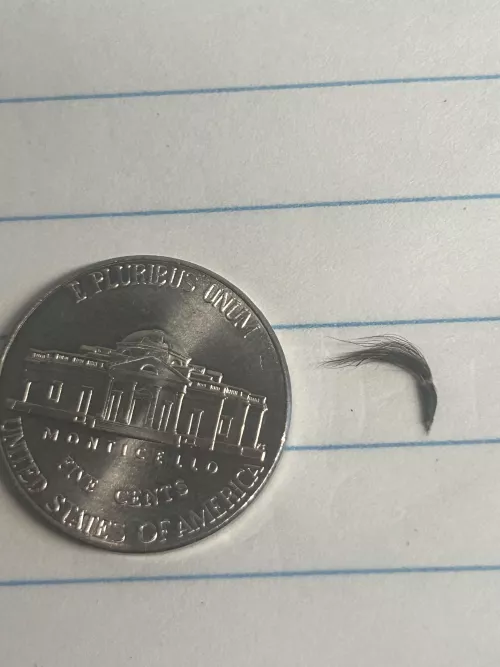 My belly button hair clump