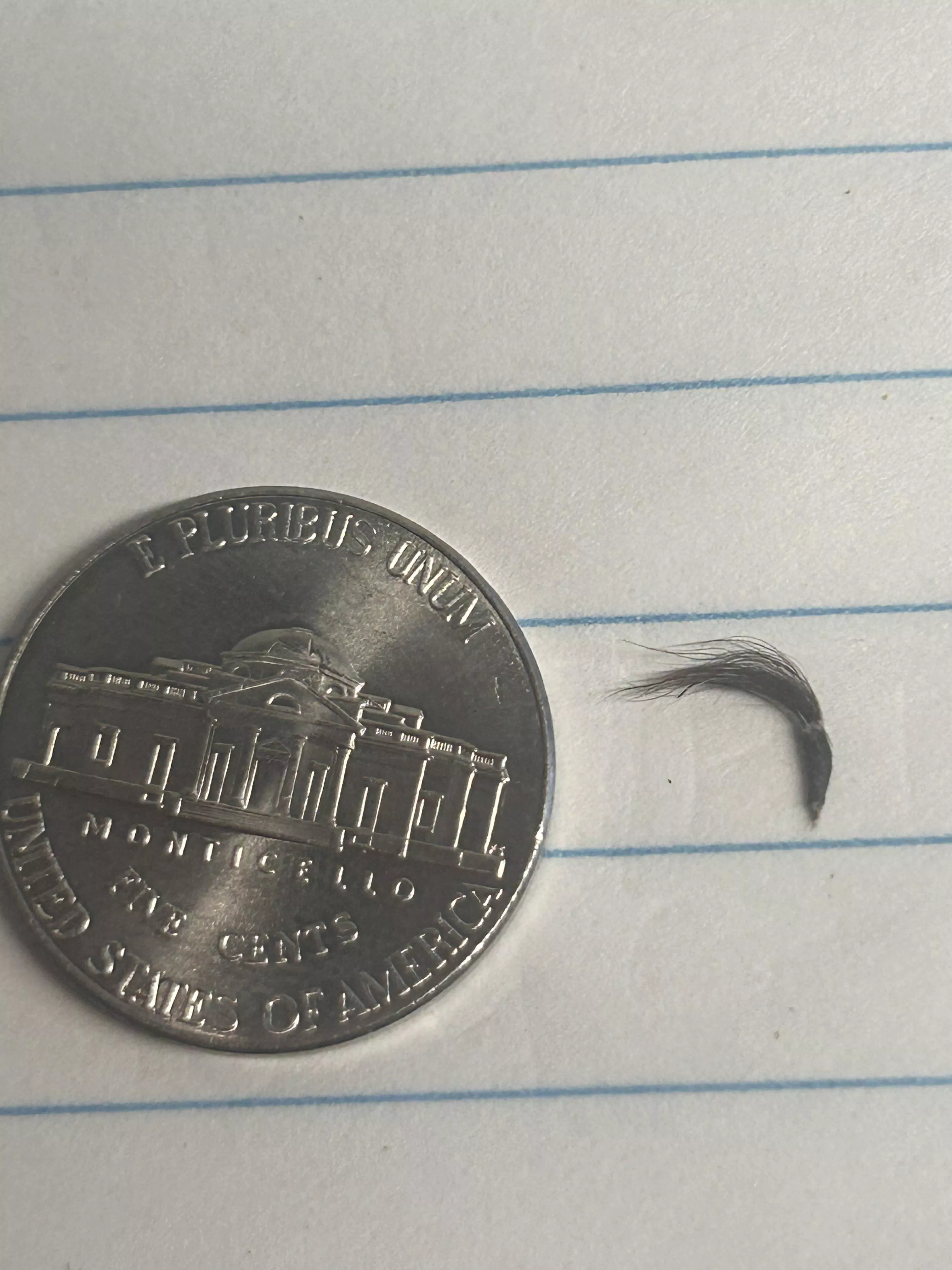 My belly button hair clump