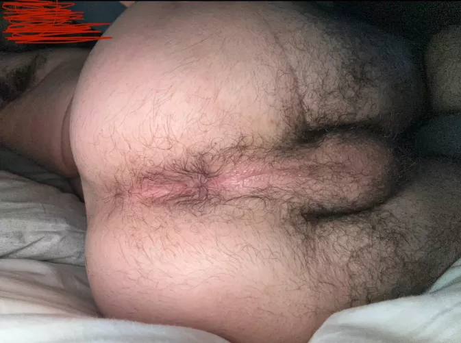 ass hair starting to grow back, thoughts?