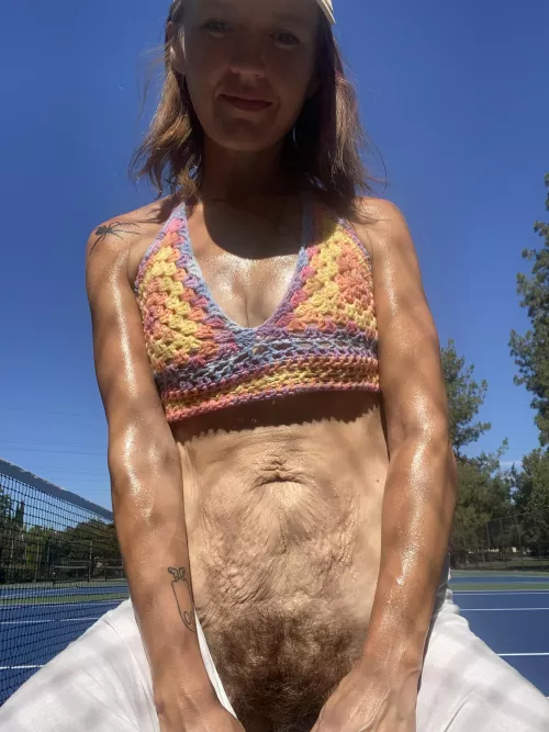 Hairy with a side of stretch marks 