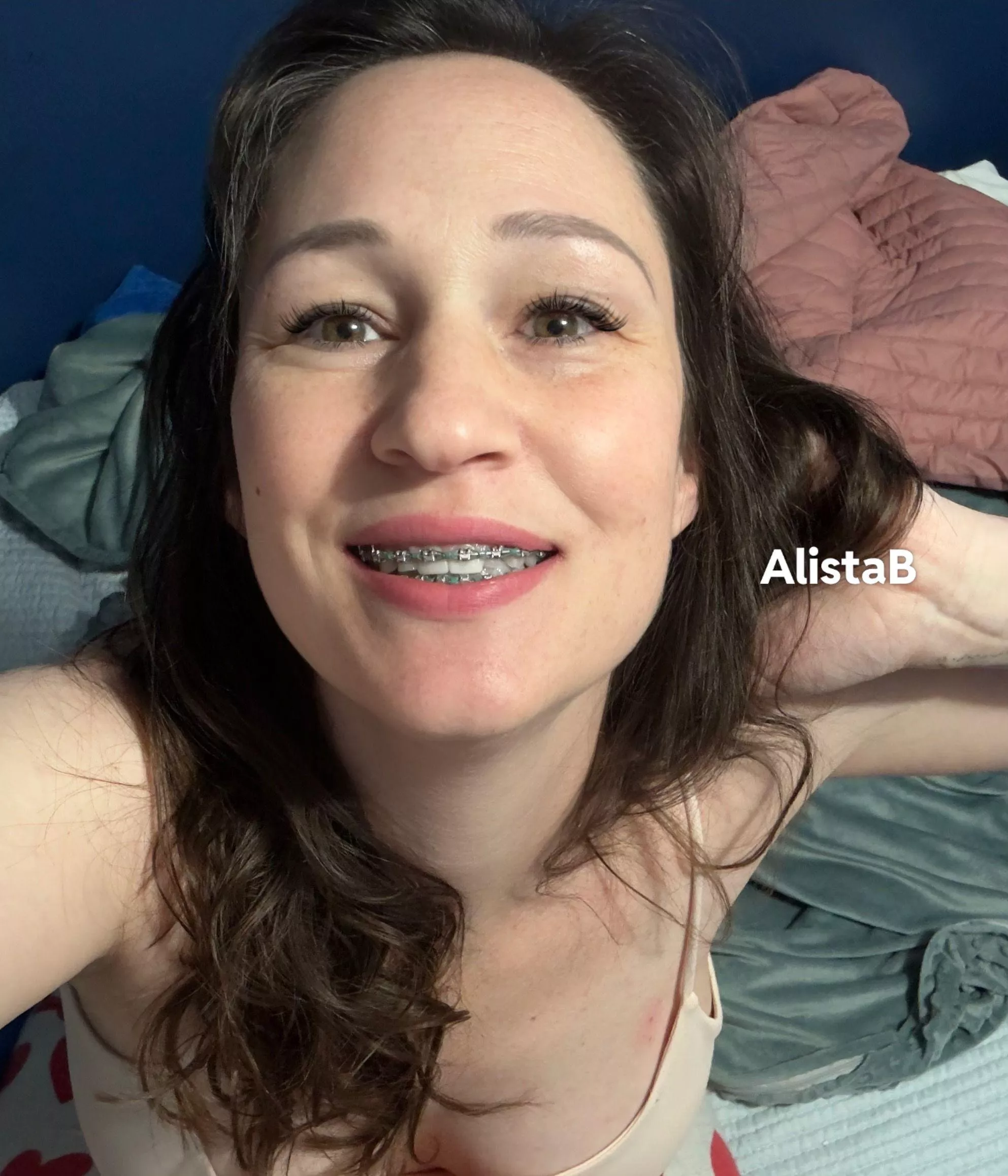 Like braces and big personalities... @alistabug