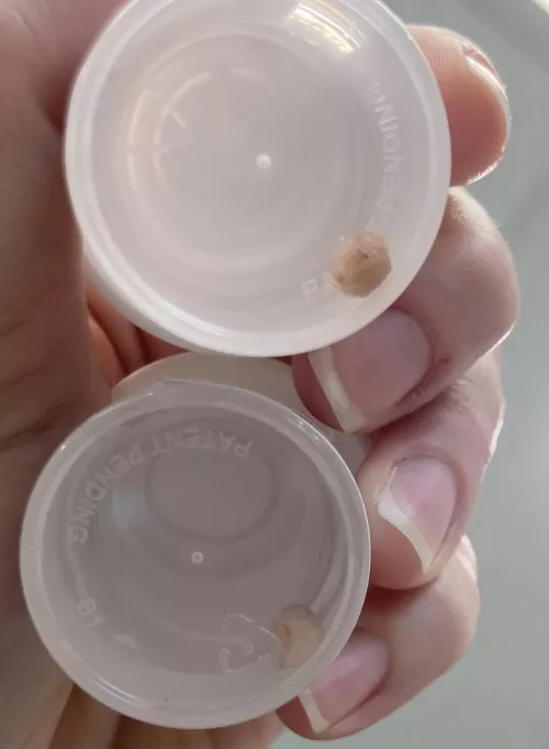 Sliced and shaved at the dermatologist!