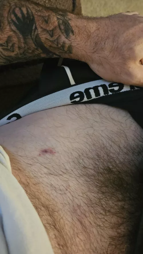 Someone get me a cold spoon.