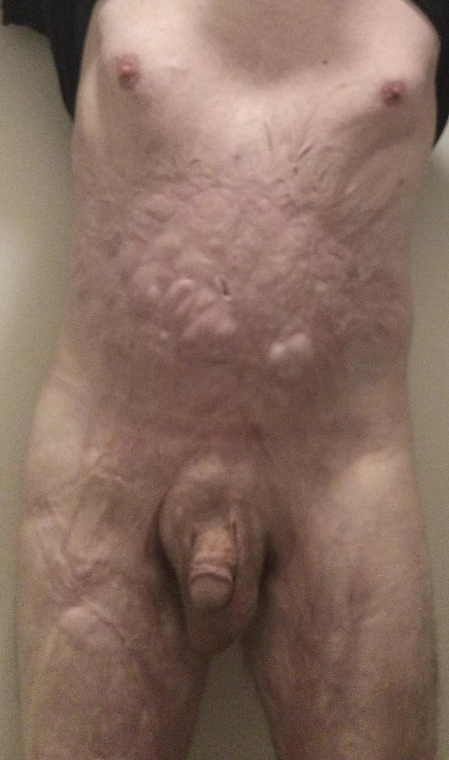 Yes