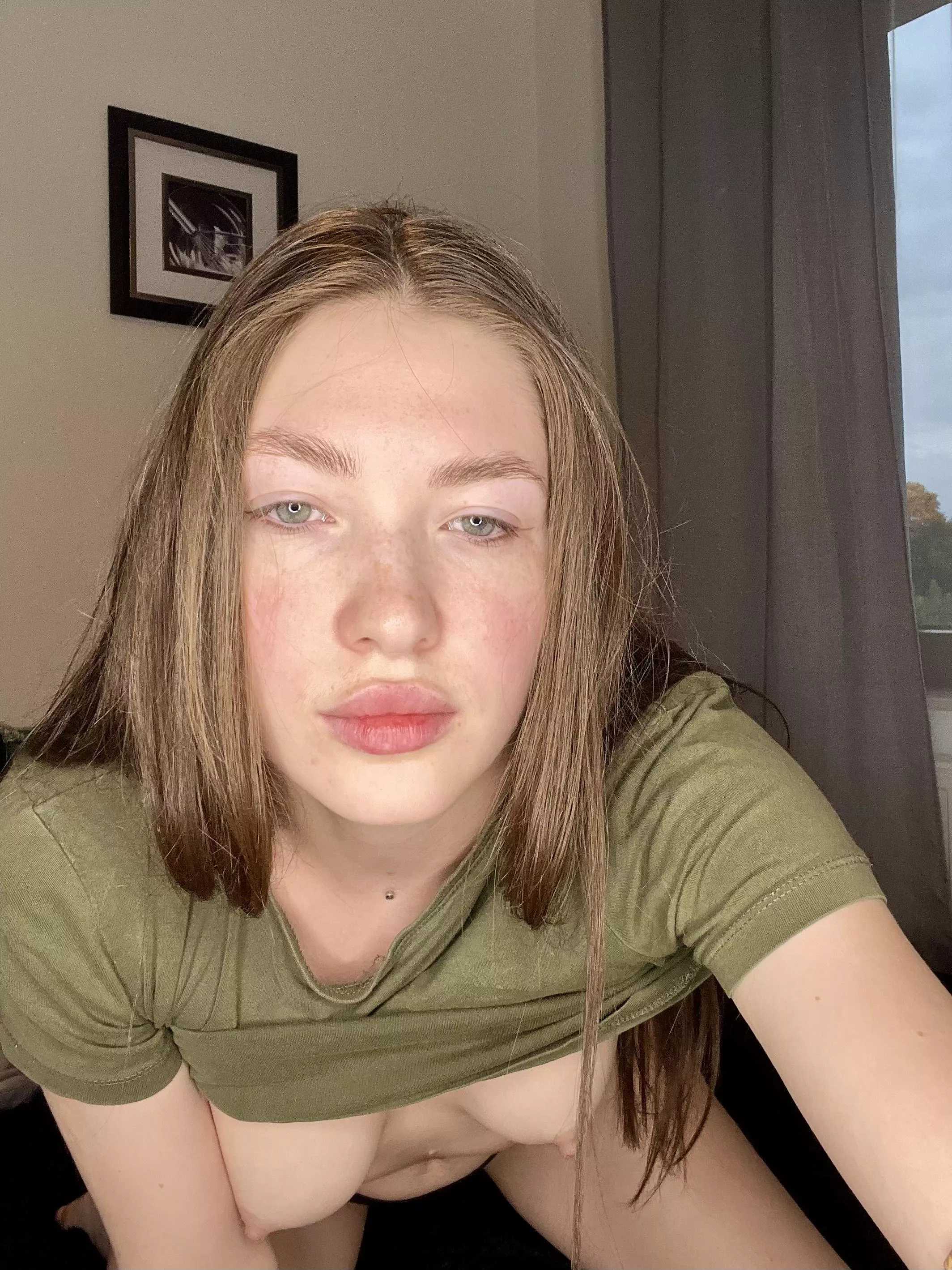 My freckles are up here [IRTR]