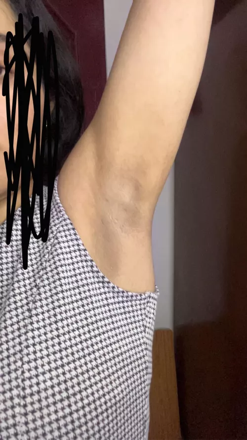 Any recommendations to lighten these underarms.