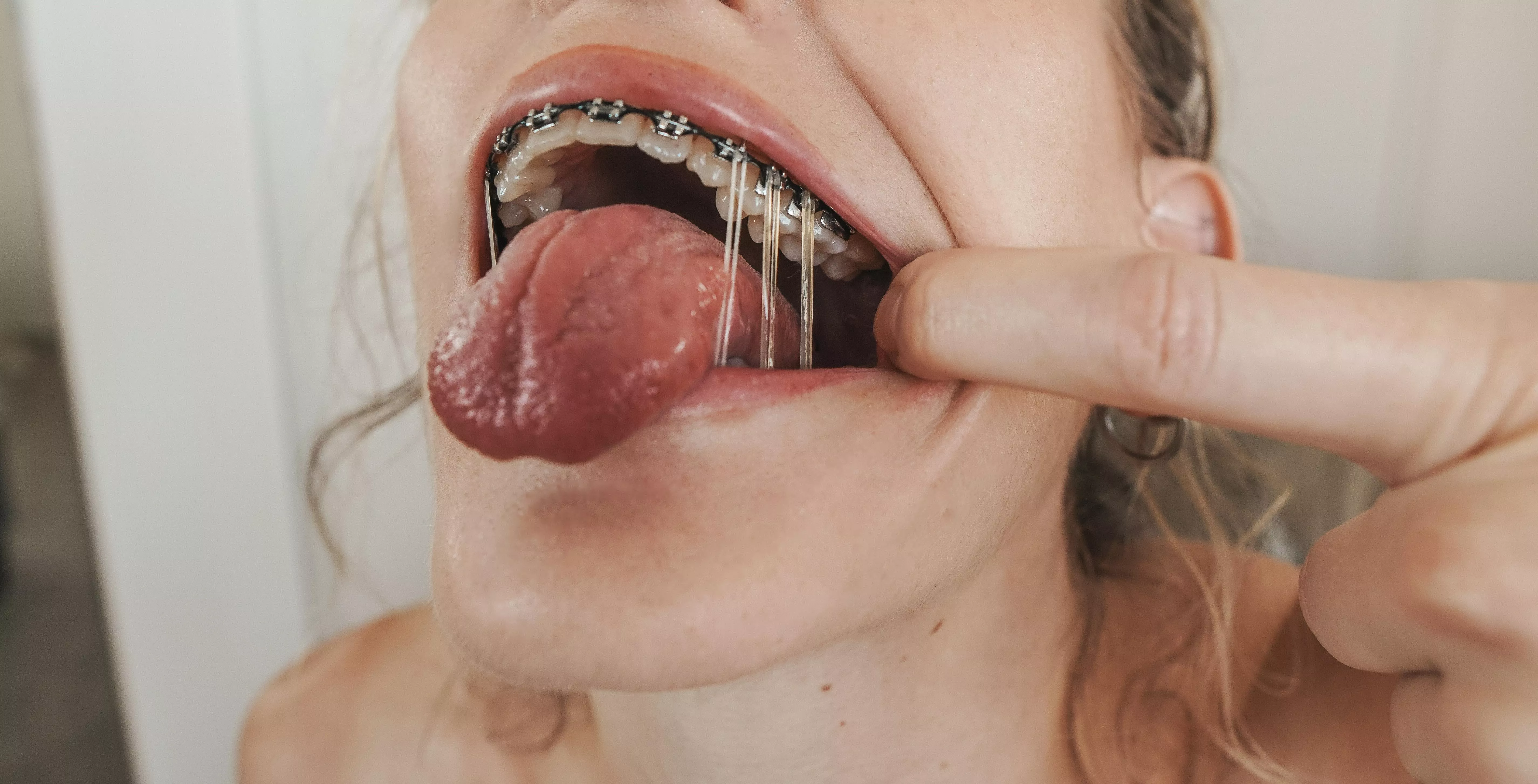 I think this is my favorite elastics configuration yet