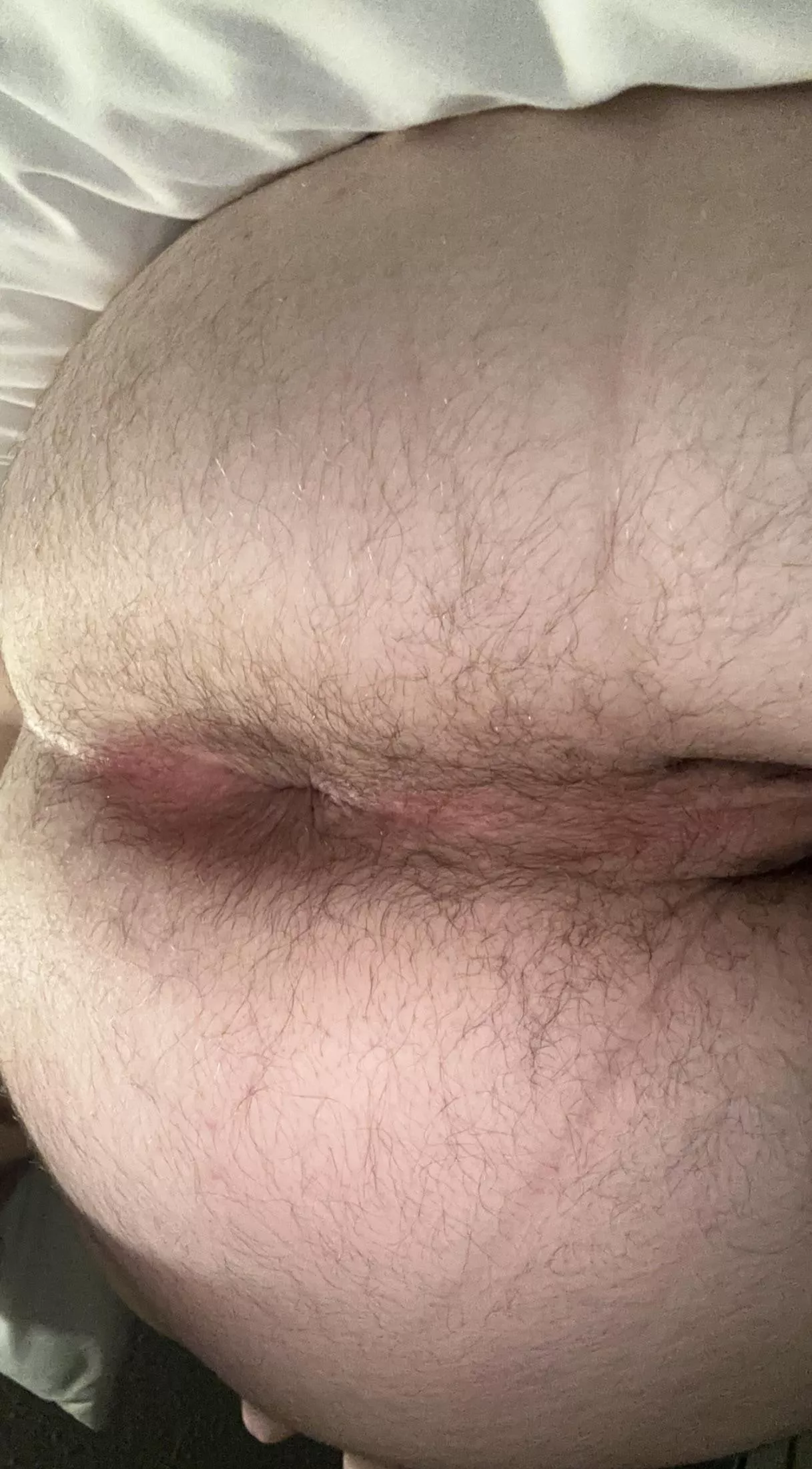 Needs attention (24)