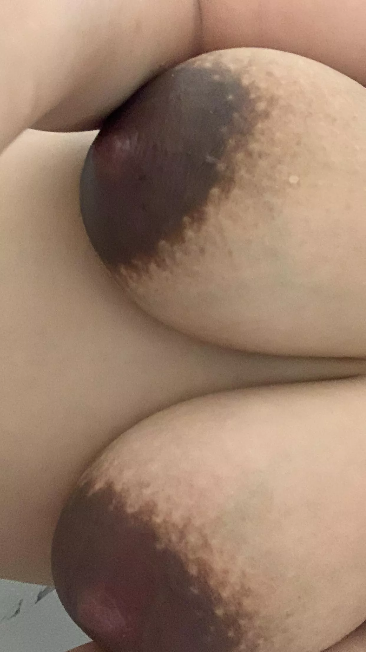 Not nipples got really dark. You still like them? 