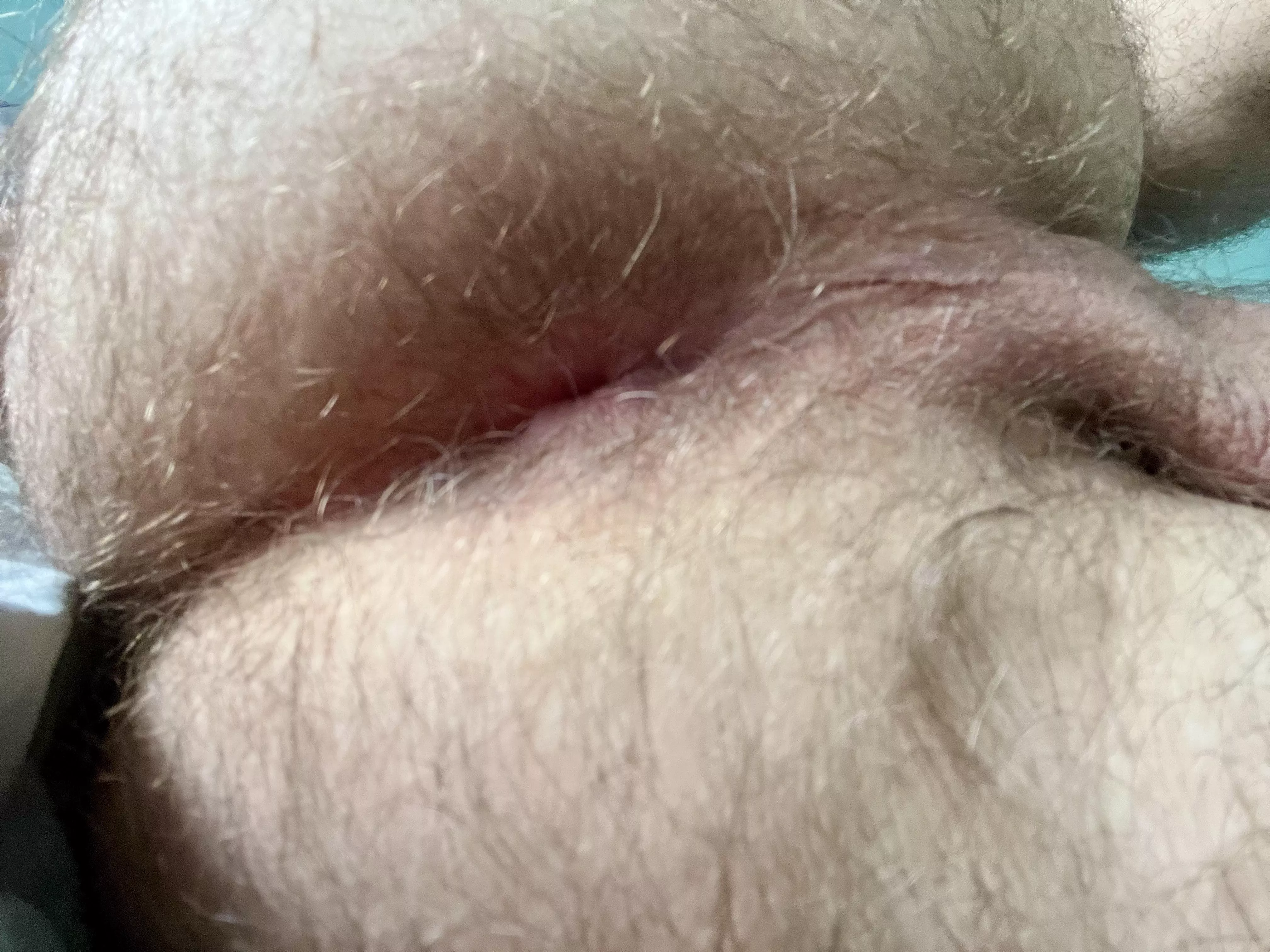 Say “yes” if you like a hairy arse 😏