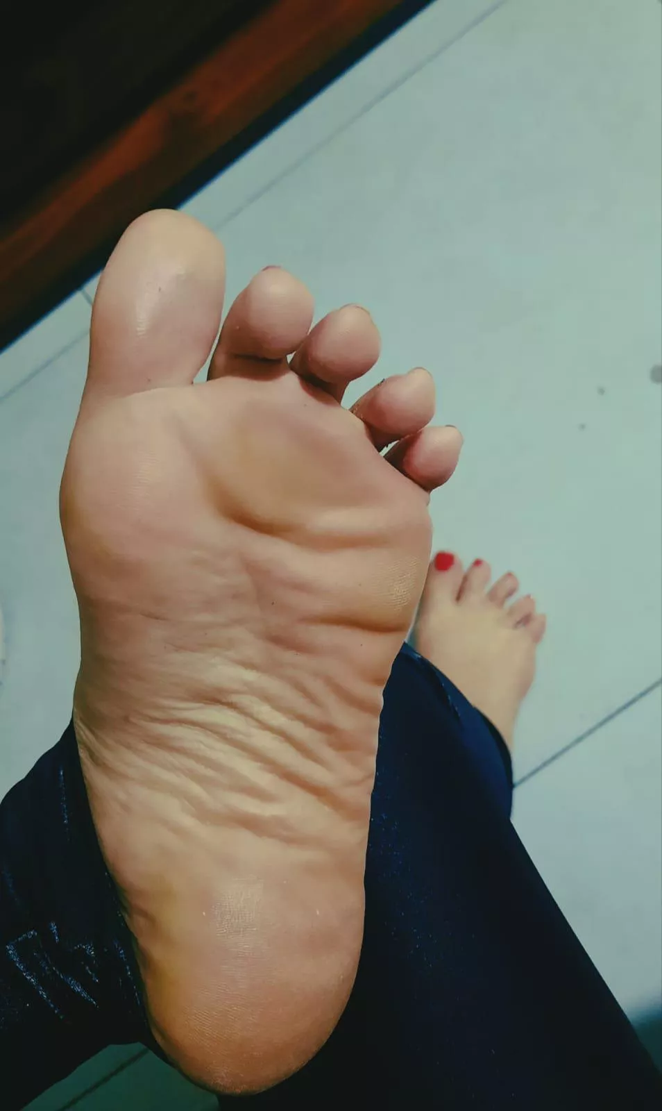 My feet need cream, what do you think?