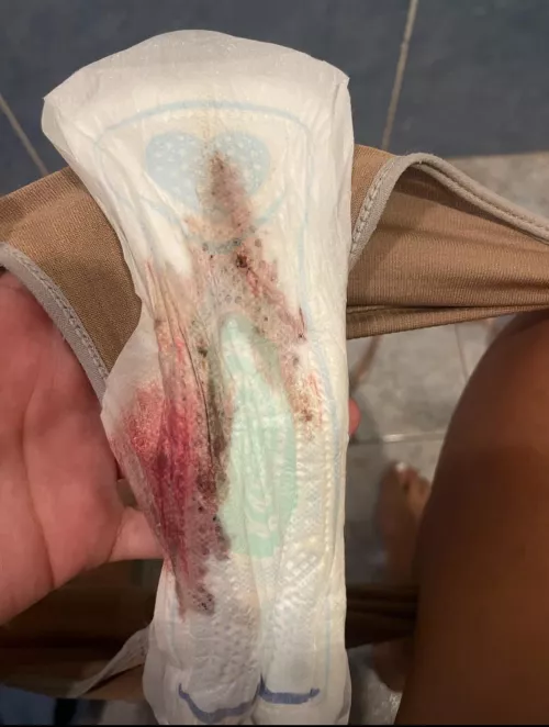 Mestruation content here 