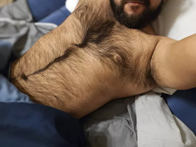 Volunteers needed to fix my happy trail!