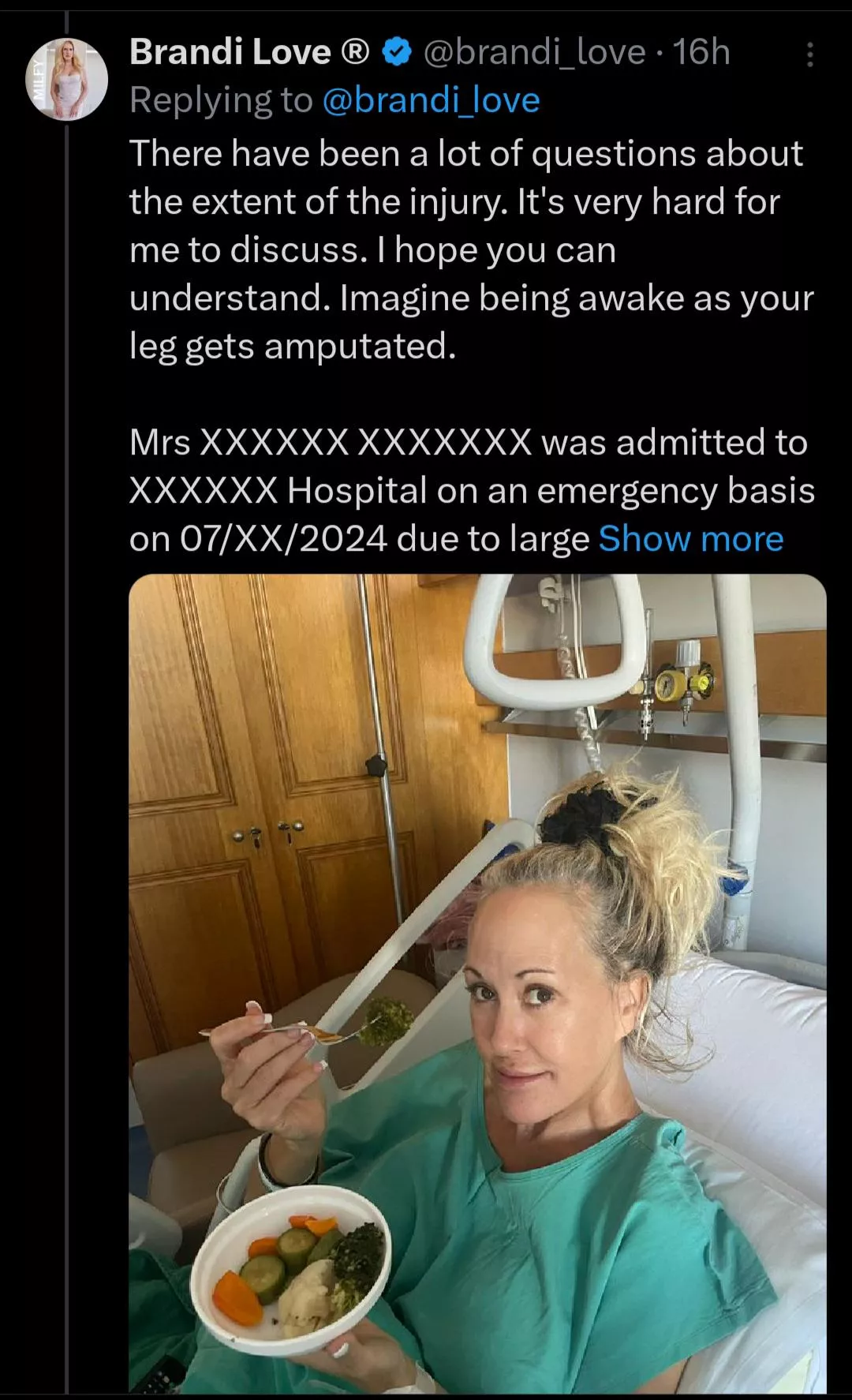 Brandi Love severely injured in boating accident during Greece trip. Leg is mangled and amputation was considered. 