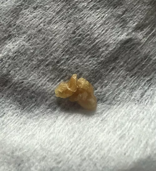 Plucked this out of my 9 month old’s nose this morning