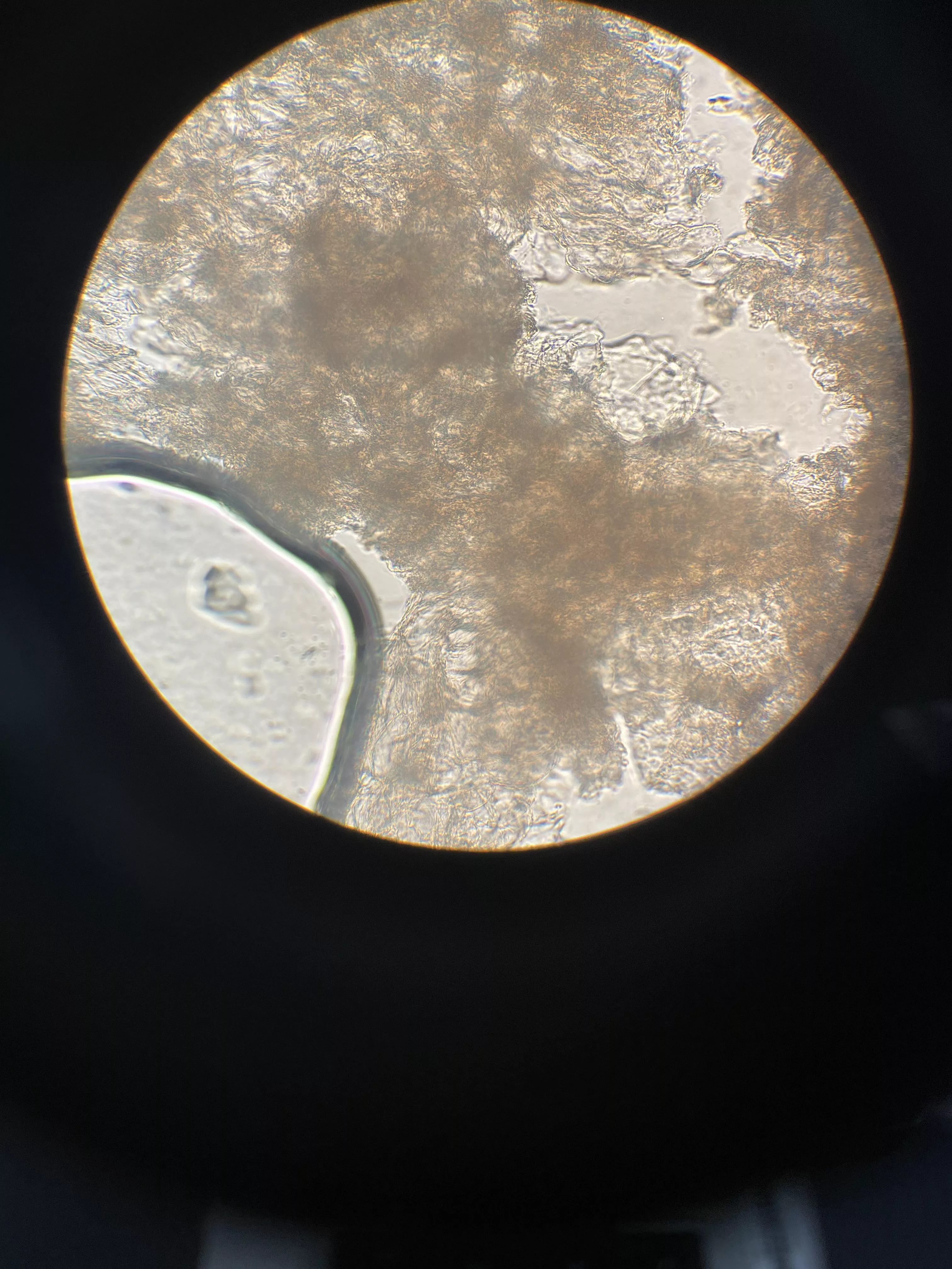 Milia under microscope