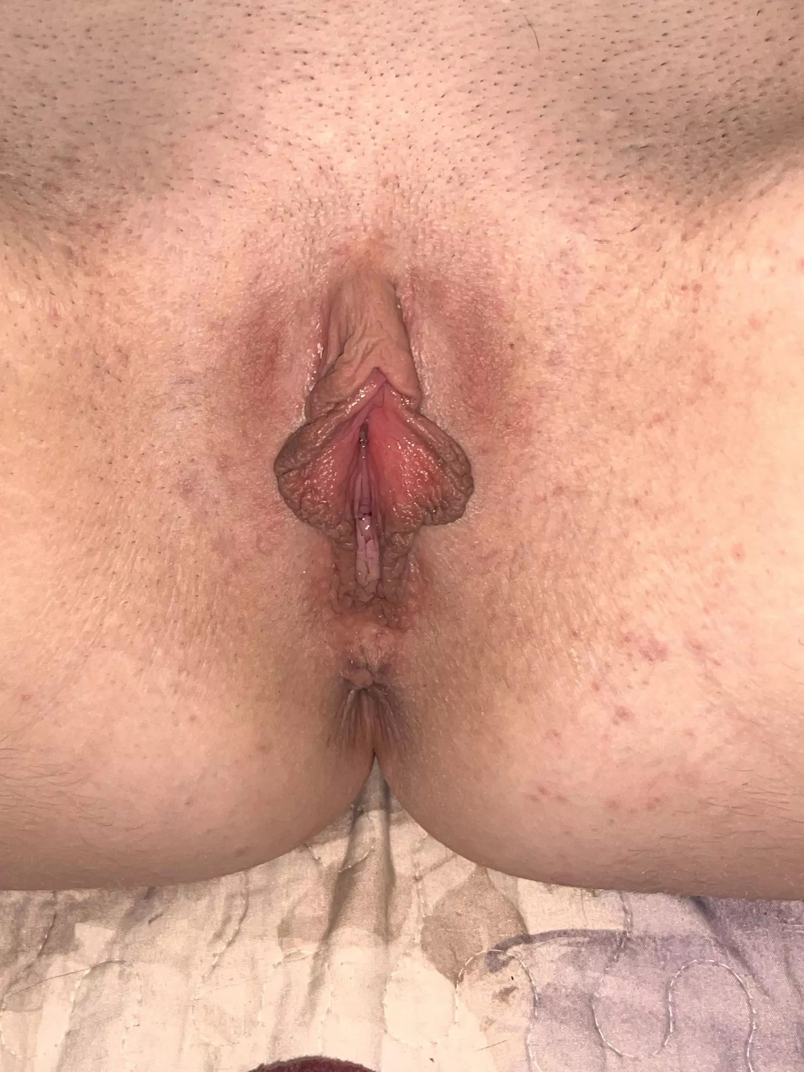 my droopy clit loves being sucked and bit 