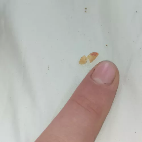 This piece of wax was right on my eardrum for years and I finally got it (the relief omg)