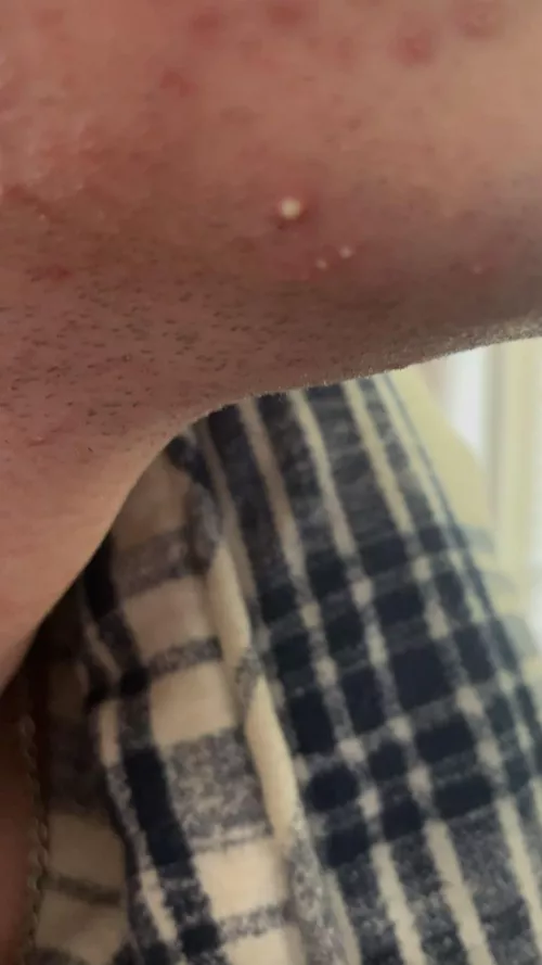 wowzers that’s taunting