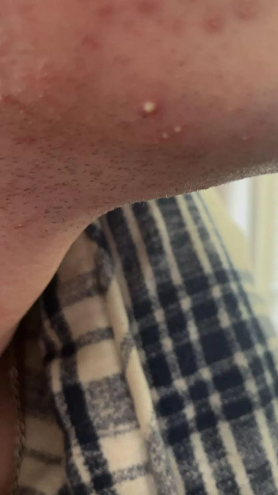 wowzers that’s taunting