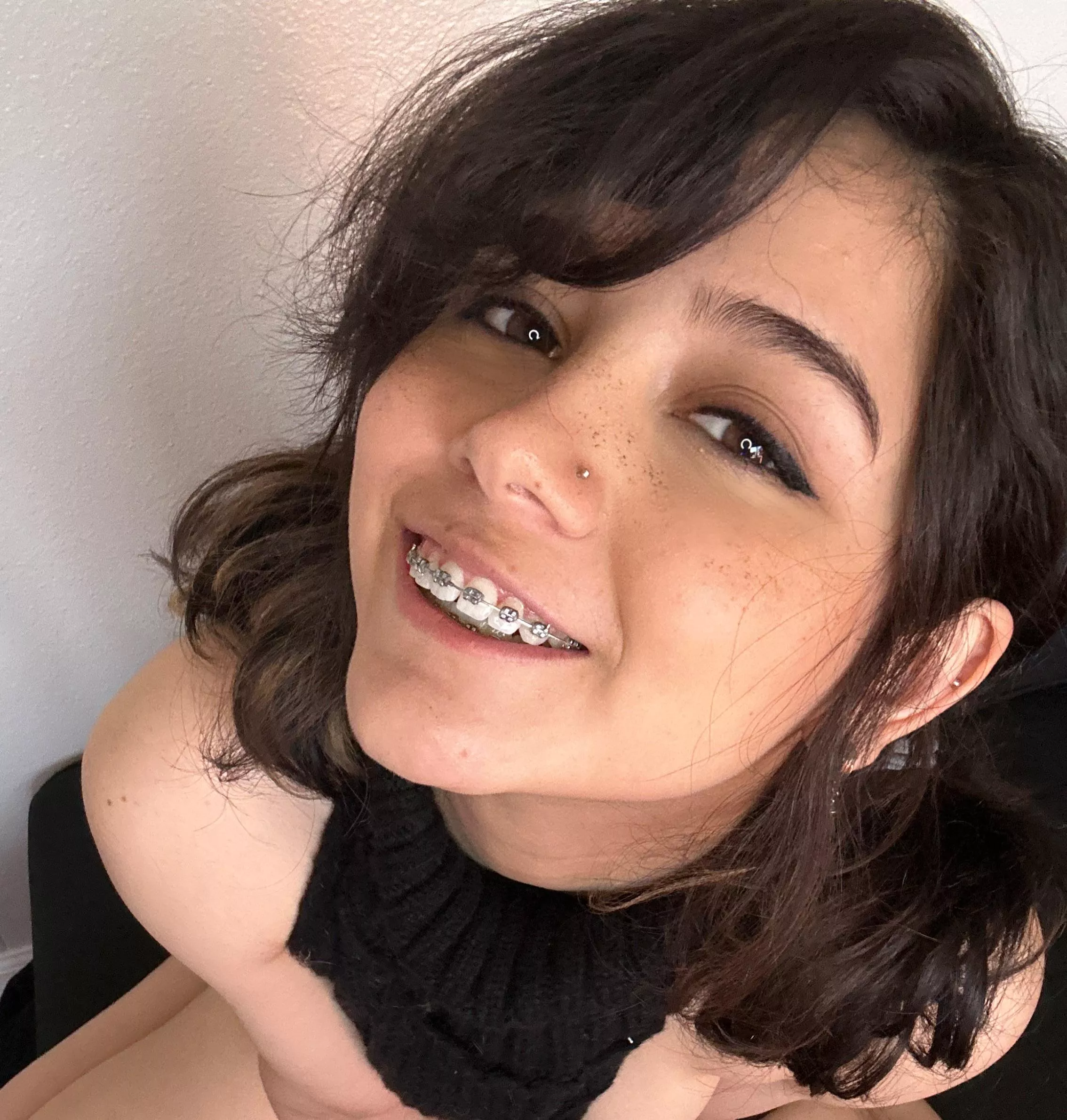 finish on my braces?