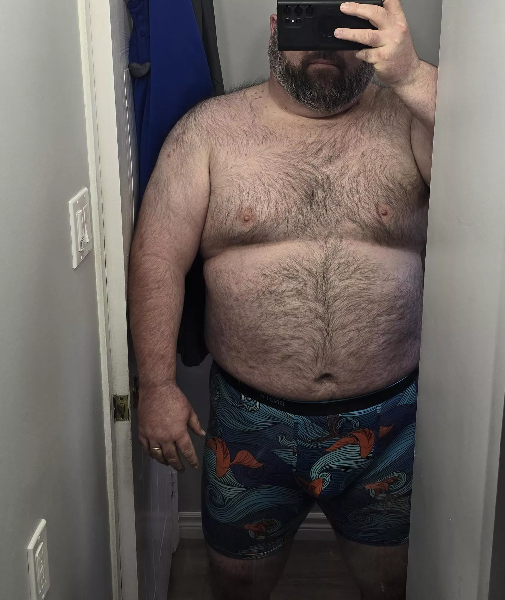 Are these boxers too 