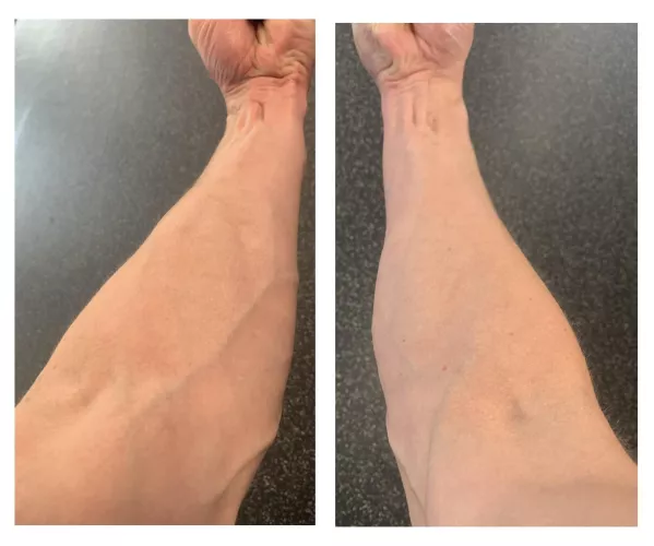 Nurses tell me they love me all the time. Must be for my charming personality.