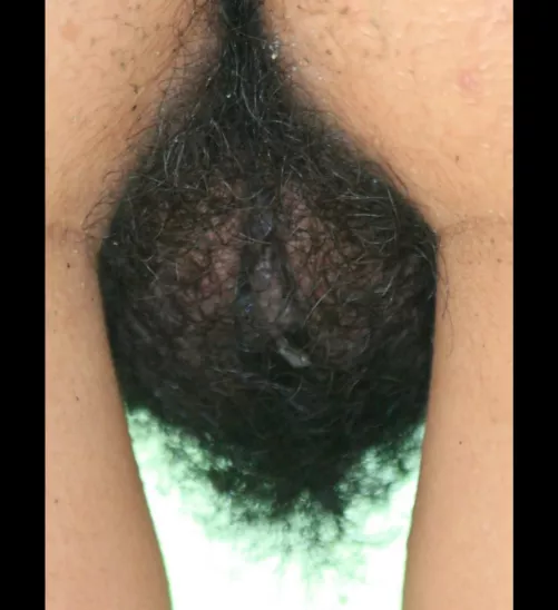 130 mm Apochromatic Quadruplet Refractor