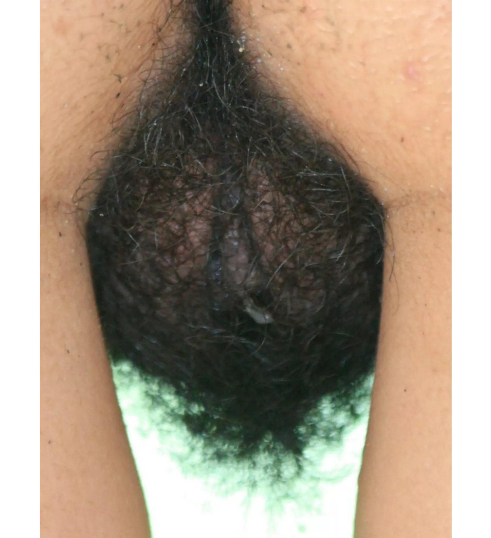 130 mm Apochromatic Quadruplet Refractor