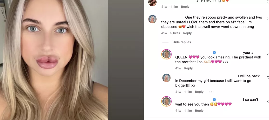 1.5ml in JUST the top lip