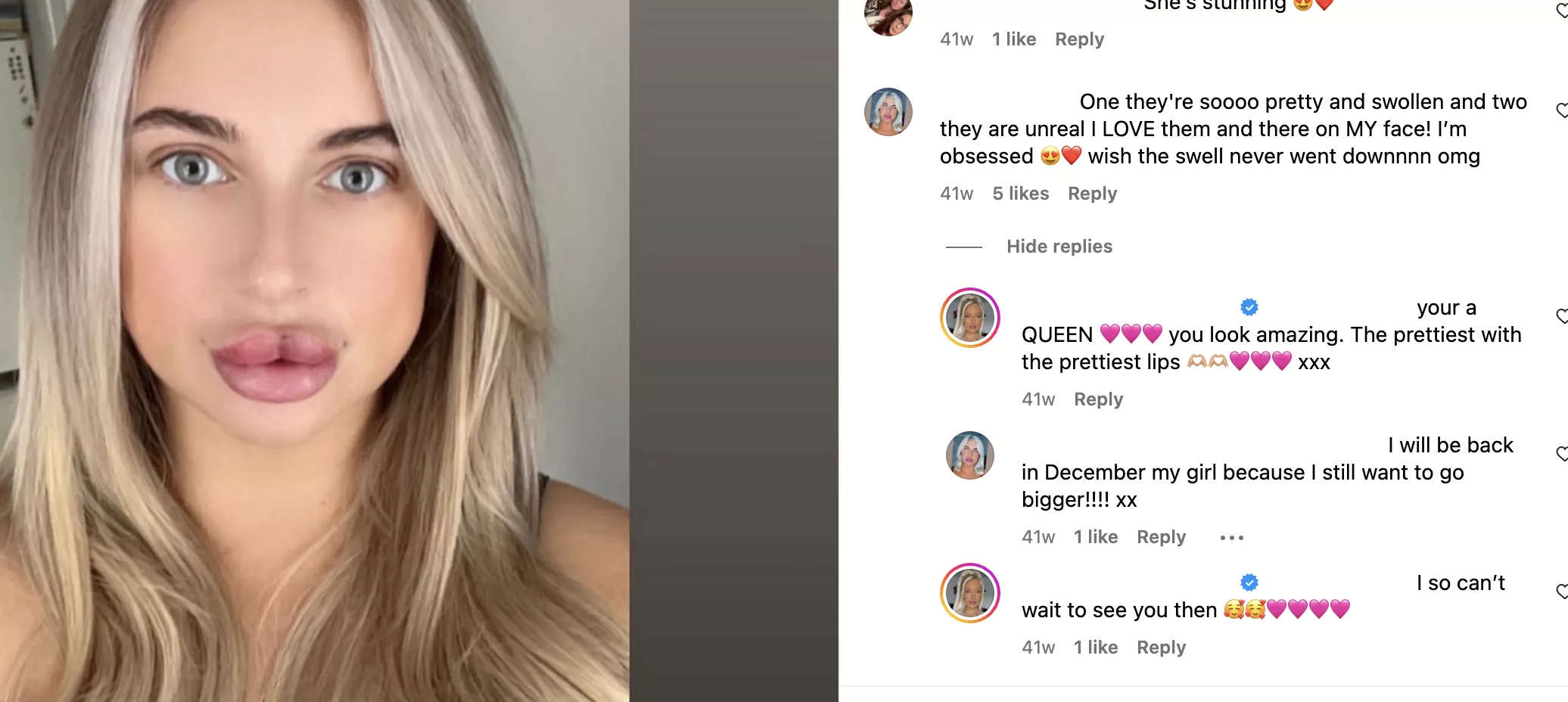 1.5ml in JUST the top lip