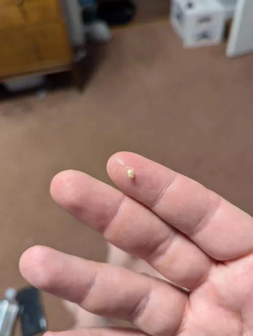 First tonsil stone in a long time.