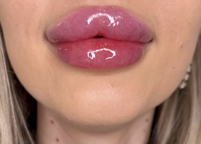 Straight off the needle