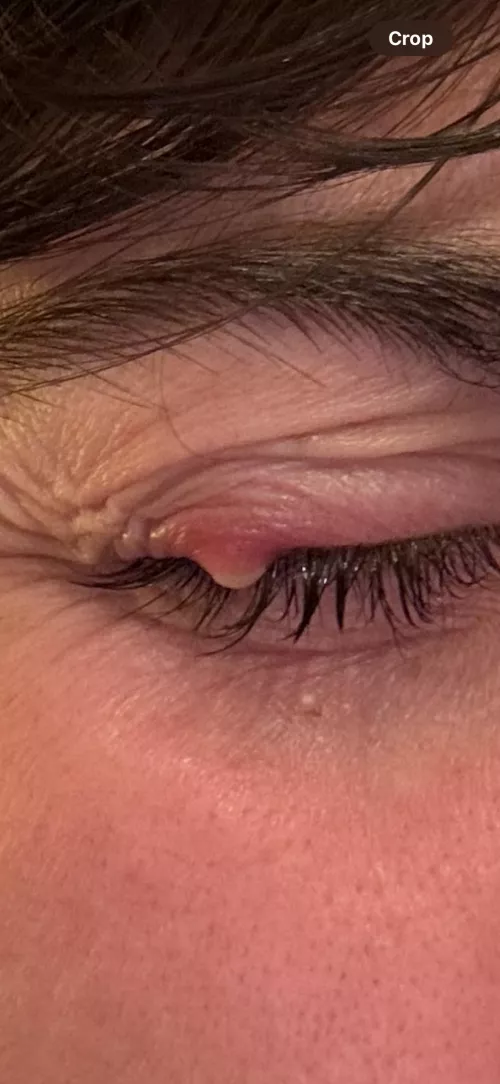 The relief id feel 😮‍💨