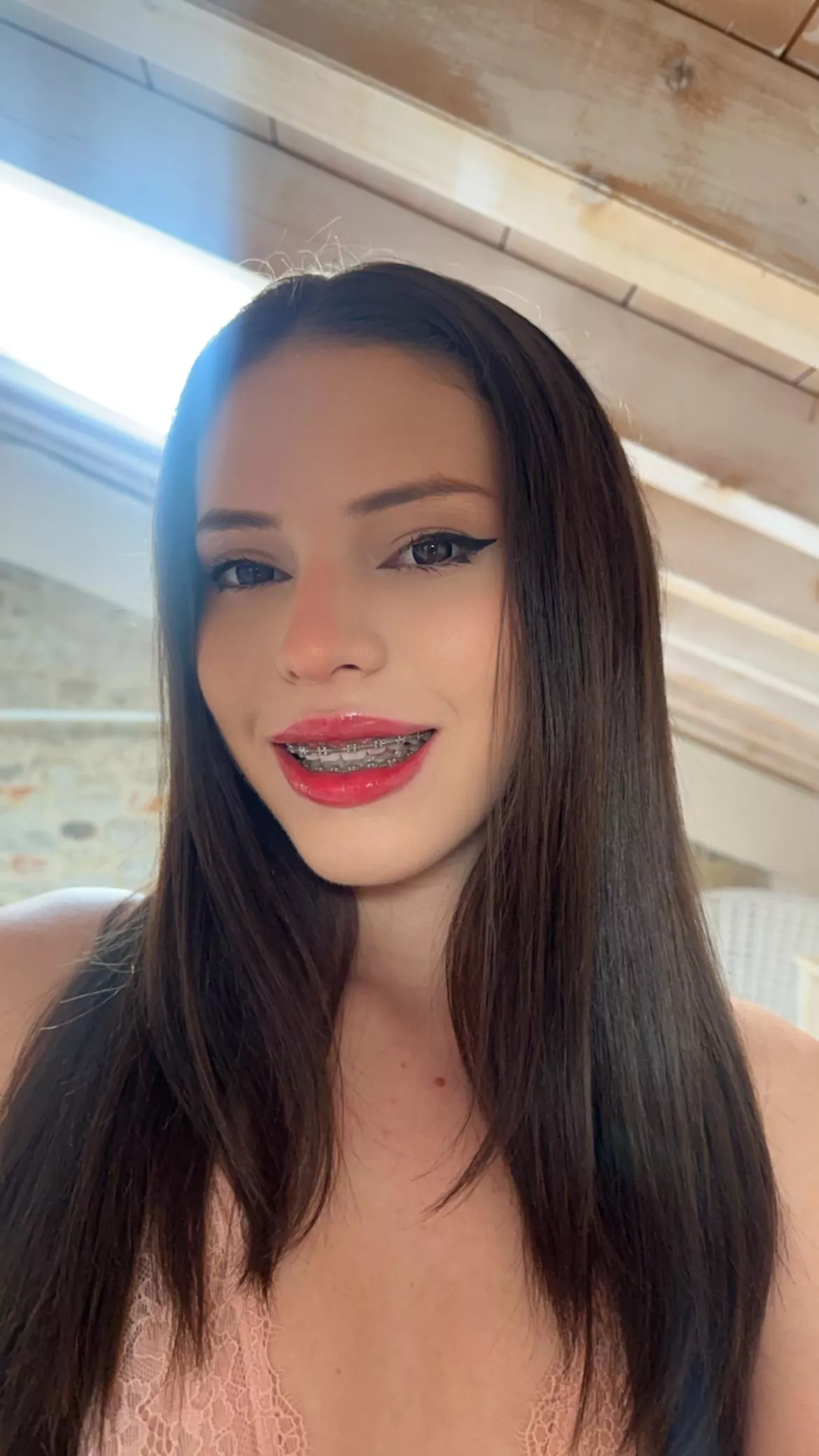 Hi there! New braces for me! 