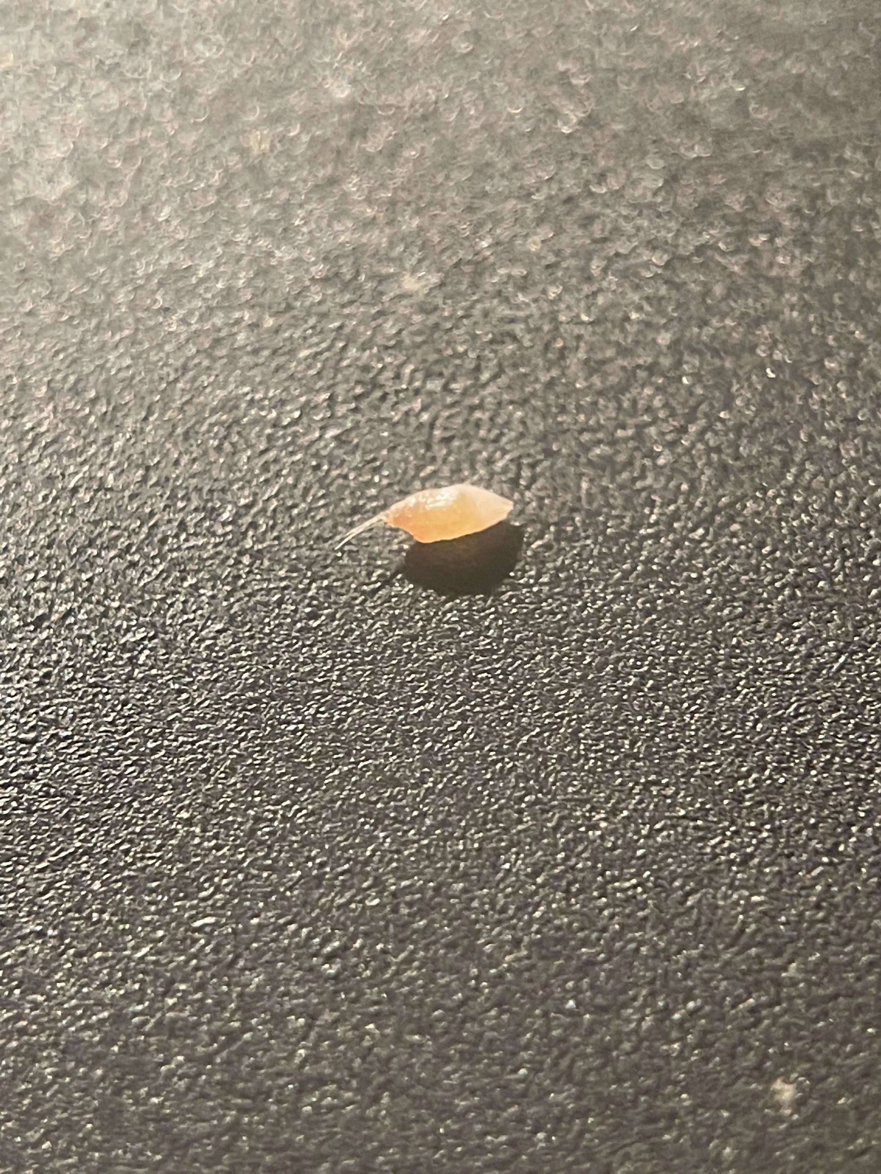 Pulled this out of my face. I thought it was a new psoriasis nodule, but no, ingrown hair