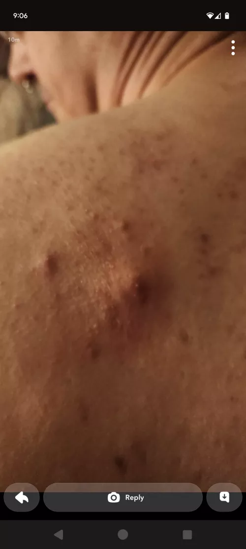 This guy and friends are brutalizing my back.