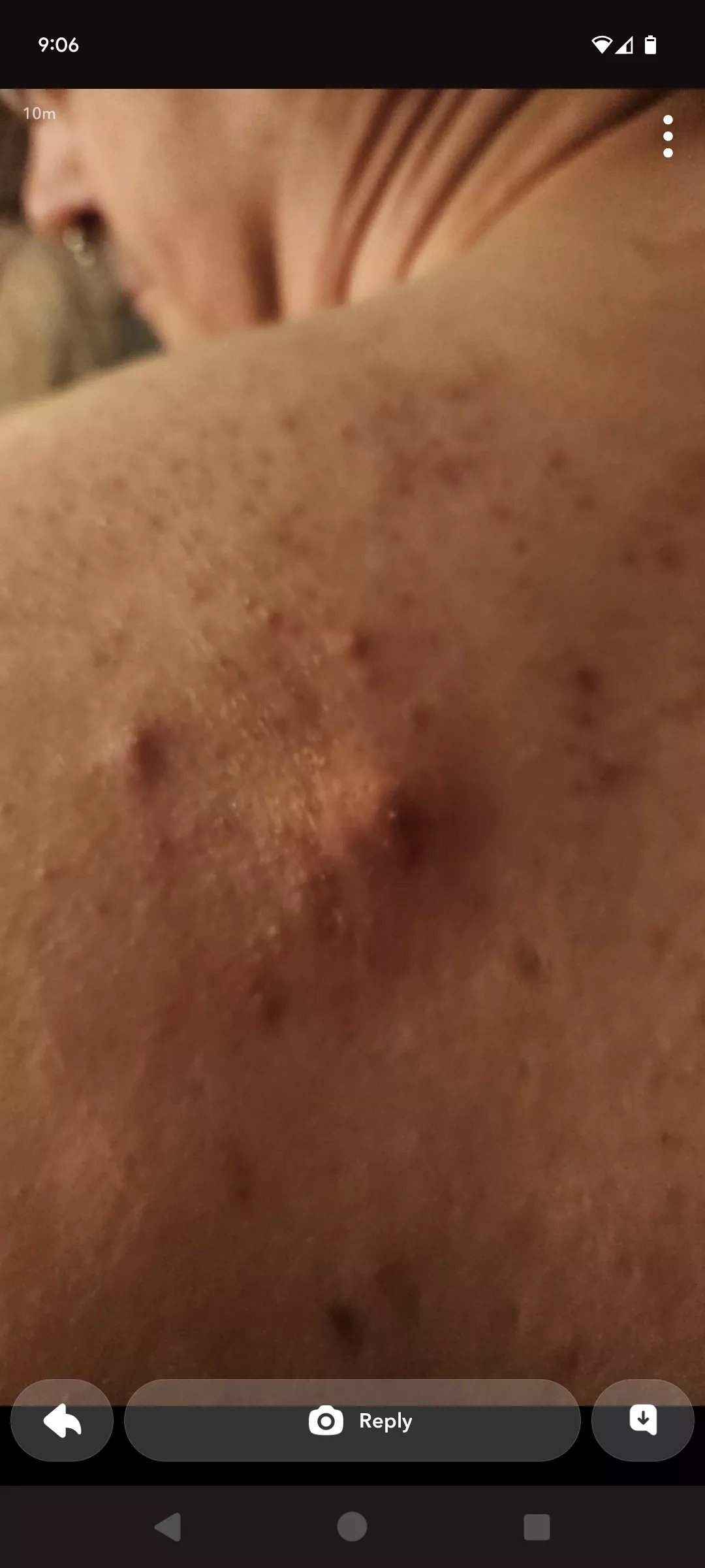 This guy and friends are brutalizing my back.