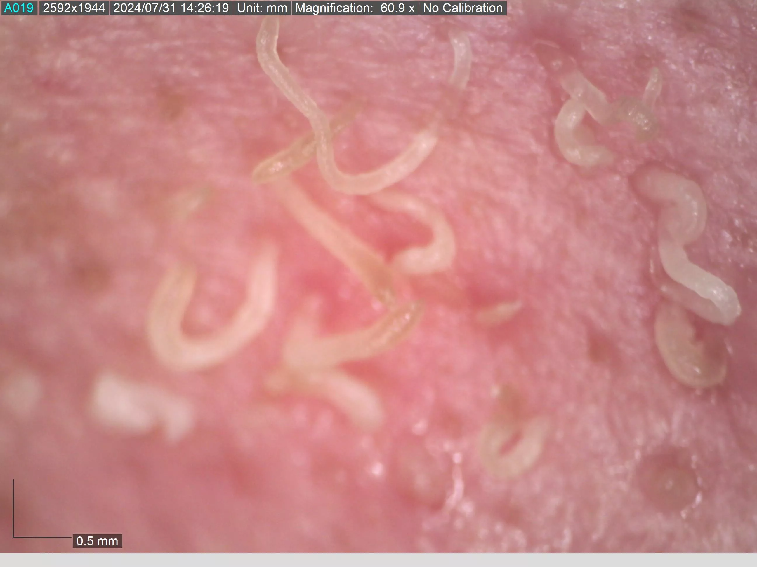 Post nose squeeze 60x magnification 
