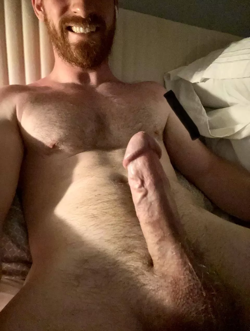 Can a sun burnt ginger turn you on?