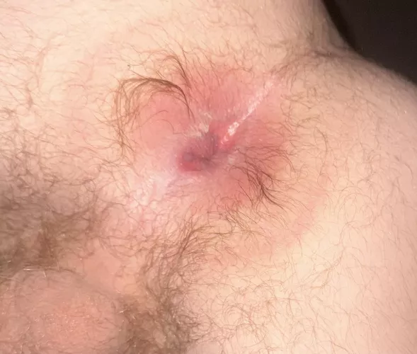 18 year old virgin ass… to shave or not to shave??