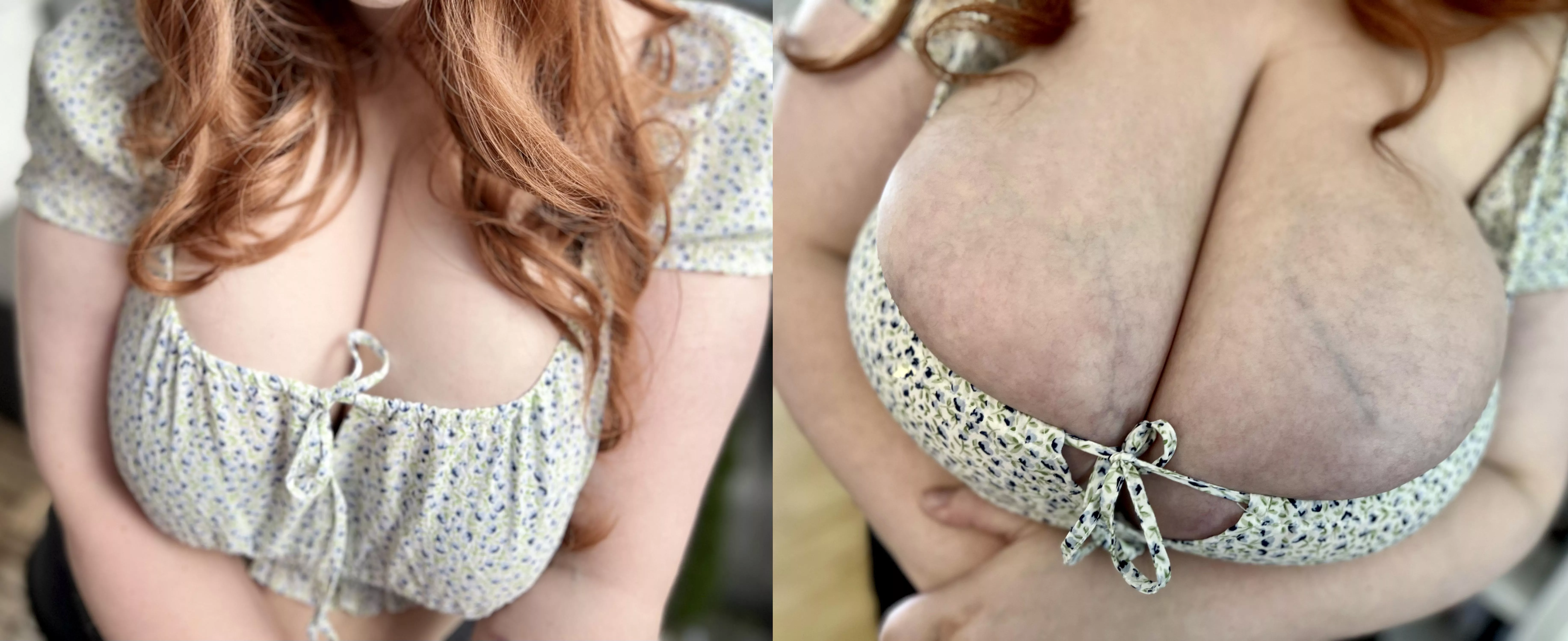 They’re getting bigger and more swollen by the day They’re getting bigger and more swollen by the day