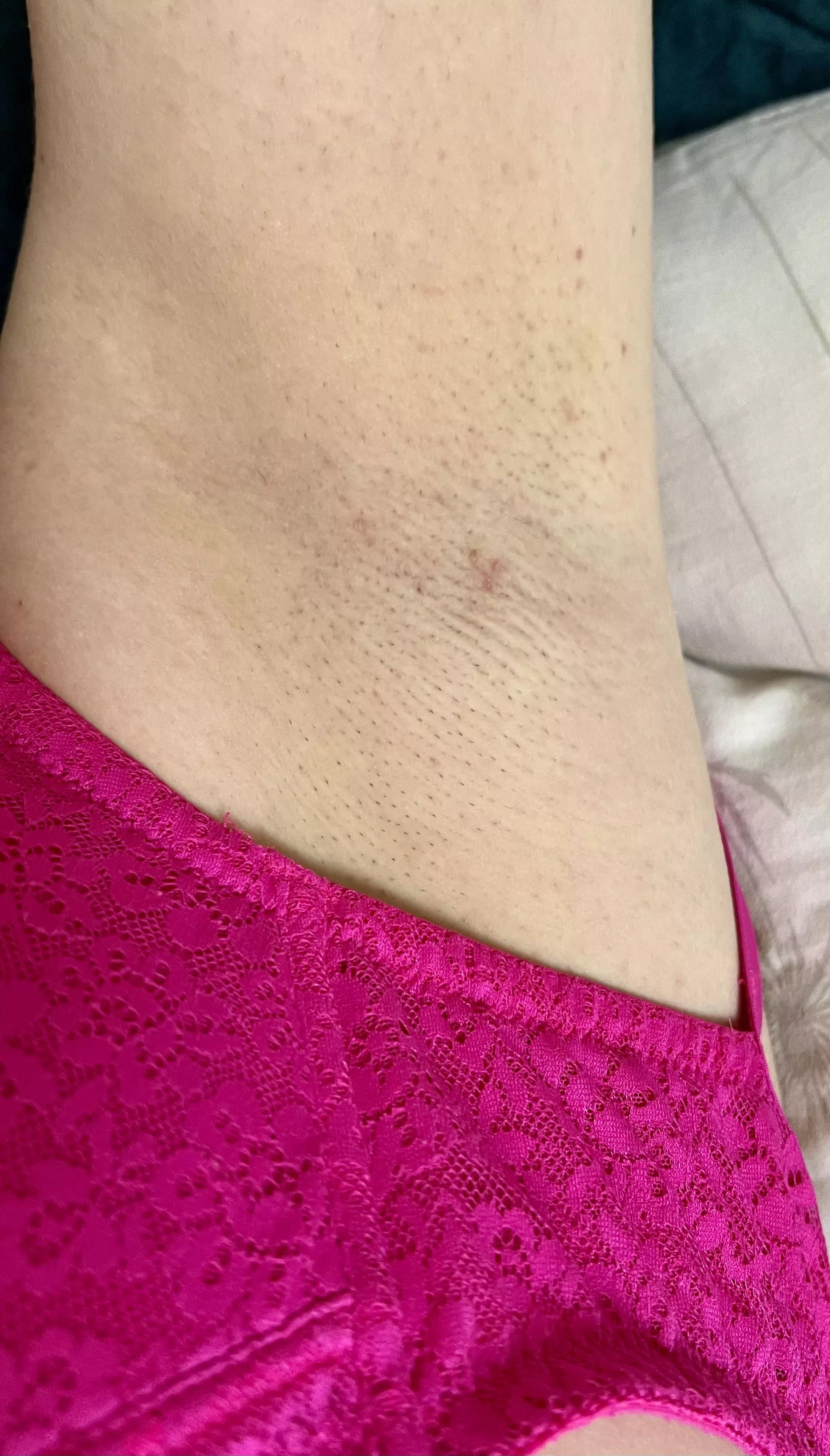 Prickly. Should I shave?