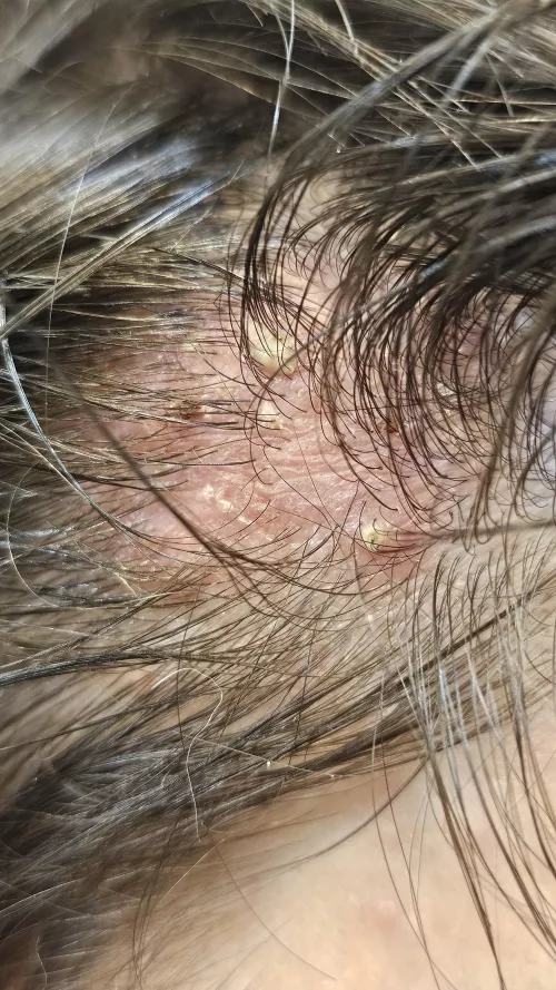 Doc says I can't pop sorry guys trust me I want to...