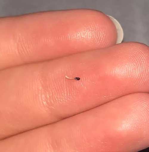 Sharp nail (?) thing poking through scalp