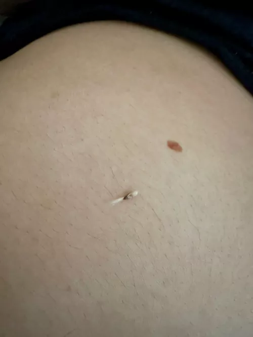 Smelly Belly Button Hair