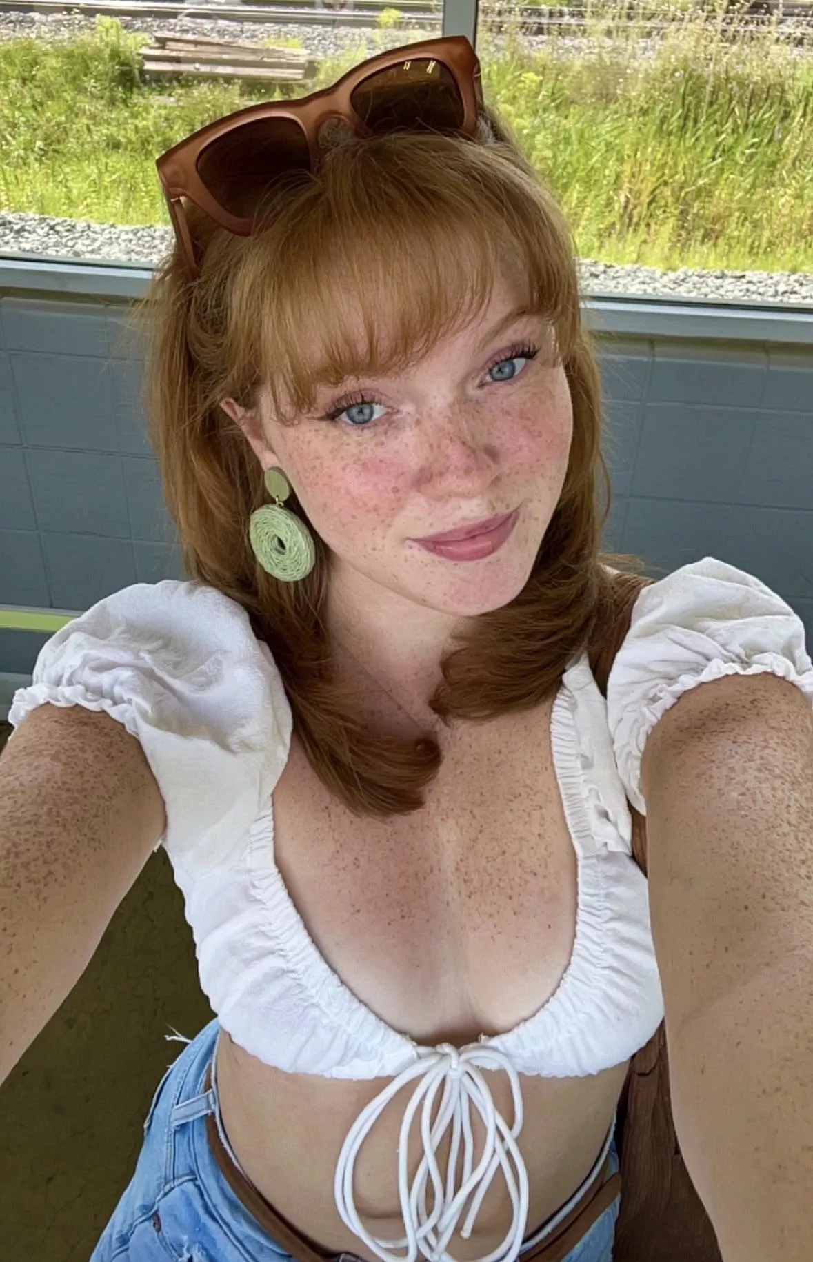 summer freckles
