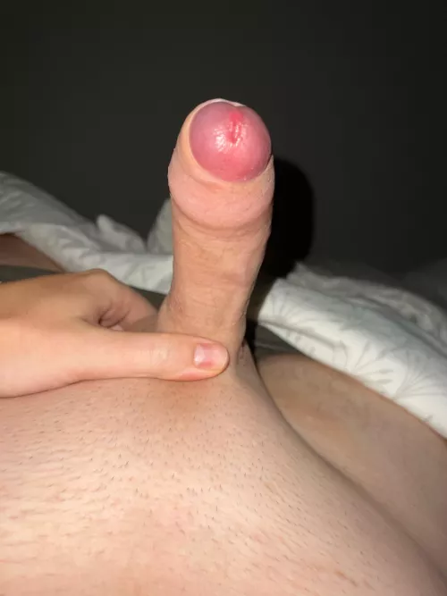 24 Dutch. What do u think of this foreskin?