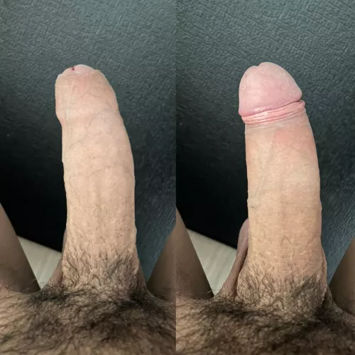 Foreskin Up, Foreskin Down