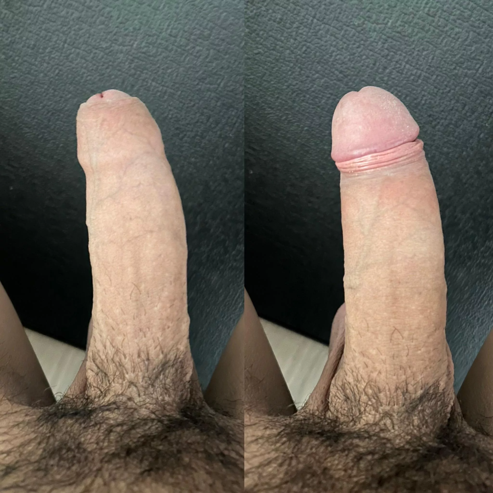 Foreskin Up, Foreskin Down